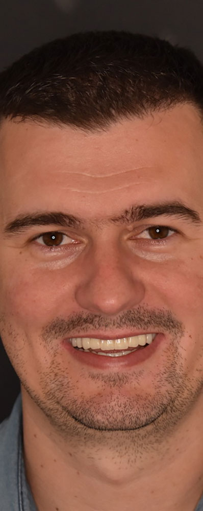 Klinički slučaj Antonio Š.