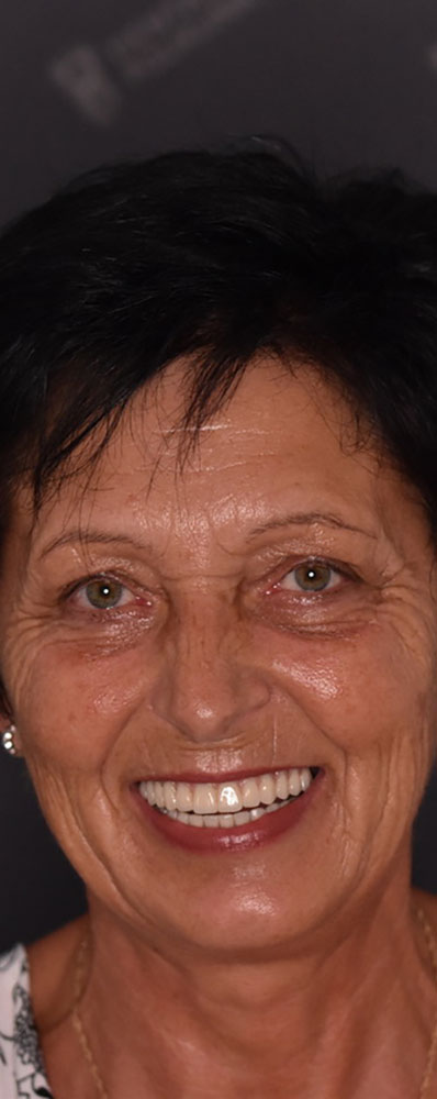 Klinički slučaj Magda M.